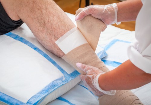 The Ultimate Guide to Dealing With Fibrinous Exudate in Wounds